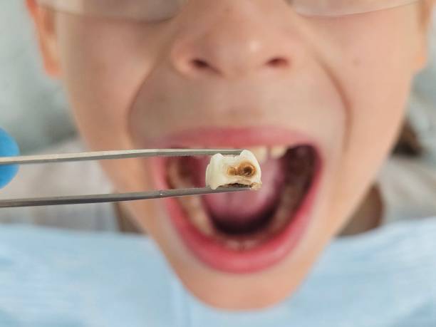 Best Emergency Dentist Near Me  in Benicia, CA